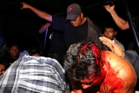S�bado 29 de junio del 2013. Tuxtla Guti�rrez, Chiapas. Polic�a se enfrenta con el bloque magisterial.