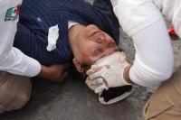 Martes 24 de noviembre del 2015. Tuxtla Gutiérrez. La persona de 60 años fue atropellada a medio día en el cruce de la Avenida y Calle Central por lo que tuvo que ser trasladada a un hospital en ambulancia de Protección Civil.