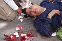 Martes 24 de noviembre del 2015. Tuxtla Gutiérrez. La persona de 60 años fue atropellada a medio día en el cruce de la Avenida y Calle Central por lo que tuvo que ser trasladada a un hospital en ambulancia de Protección Civil.
