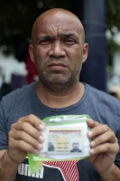 20240729. Tuxtla. Venezolano con los ojos dañados por la explosión de granadas de gas lacrimógeno durante las refriegas policiacas se encuentra en el campamento de migrantes en Chiapas.