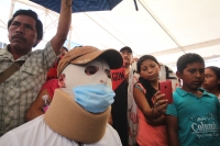 Miércoles 17 de junio del 2015. Tuxtla Gutiérrez, Agustín Gómez Pérez, joven inmolado durante las protestas del mes de diciembre pasado durante su conferencia de prensa momentos antes de regresar a la comunidad Chigton en el municipio de Ixtapa.