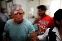 Varios pacientes con cataratas esperan ser tratados esta mañana por médicos de Israel durante la campaña de operaciones en el Hospital Regional de Tuxtla Gutiérrez, Chiapas.